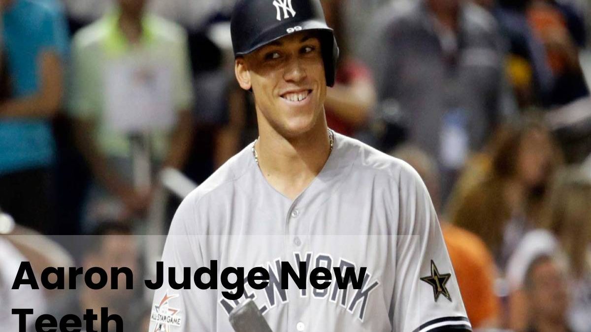 Aaron Judge New Teeth