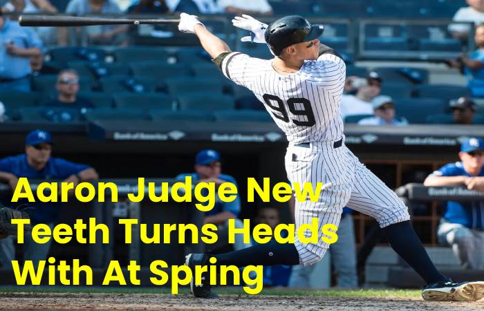 Aaron Judge New Teeth